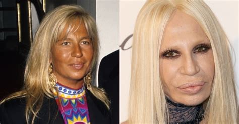 donatela versace antes e depois|Donatella Versace estilo.